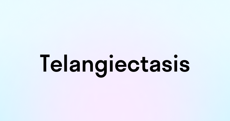 Telangiectasis