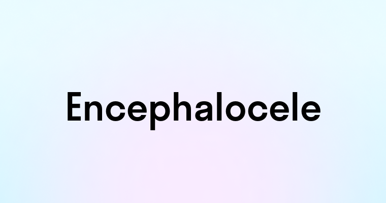 Encephalocele