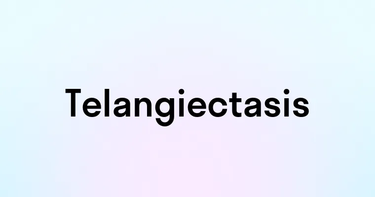 Telangiectasis